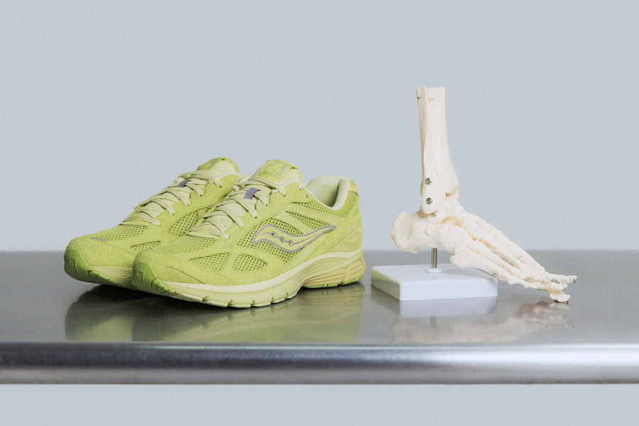 A neon yellow shoe on a metal table with a skeletal model of the foot.
